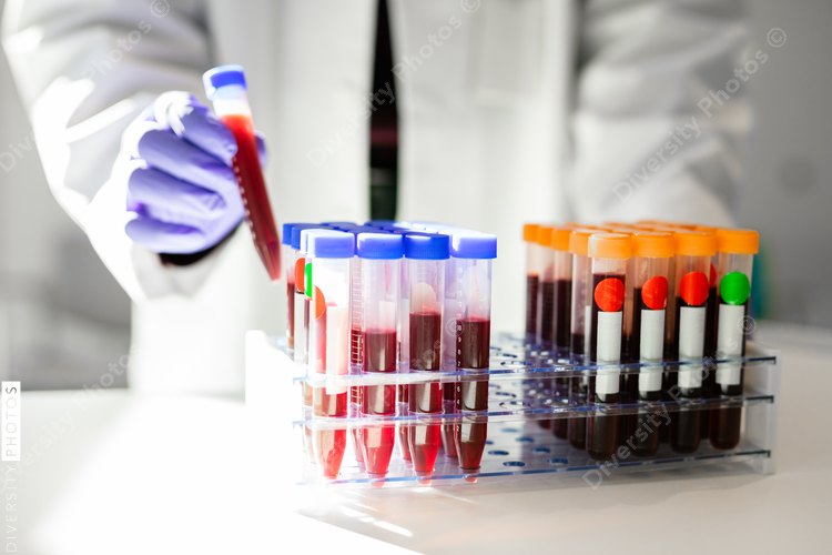 Medical professional collecting blood samples