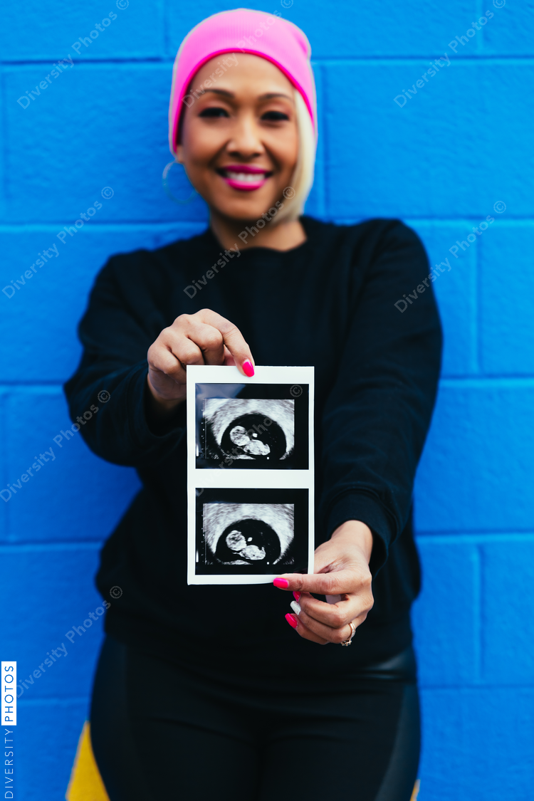Woman holding sonogram on colorful wall - baby gender reveal