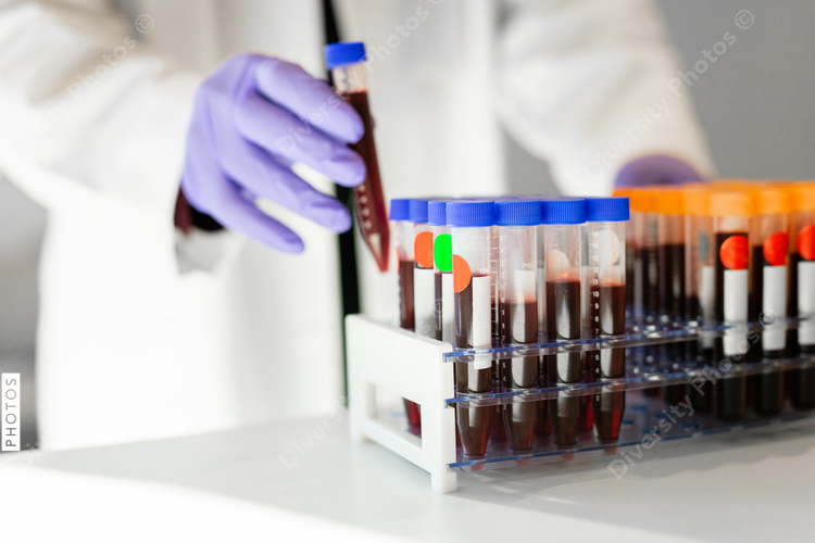 Medical professional collecting blood samples