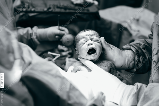 Black newborn first cry after being born