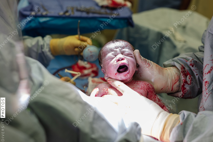 Black newborn first cry after being born